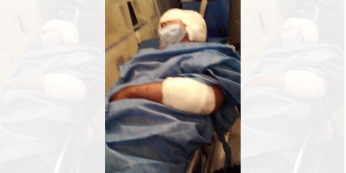 Un joven de Monteros le pelea a la vida tras ser atacado a machetazos