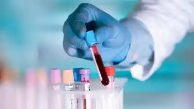 El trastorno de la sangre que se esconde en Rosario y muchos desconocen