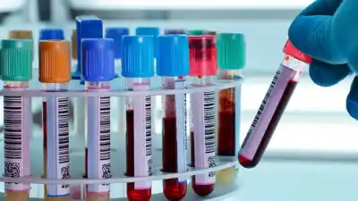 Los laboratorios de Chubut piden que la unidad bioquímica pase a $2.500 y avisan que podrían suspender servicios