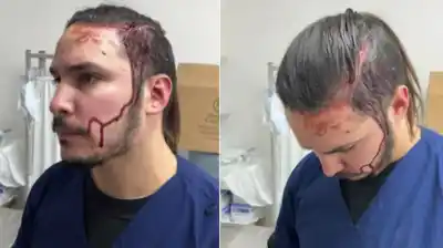 Murió una caniche en una castración y el dueño atacó a trompadas al veterinario: el momento exacto de la agresión