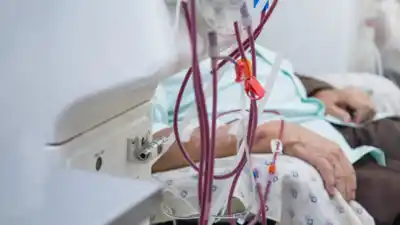 PAMI recortó incentivos a la diálisis en Catamarca: qué riesgo corre la prestación
