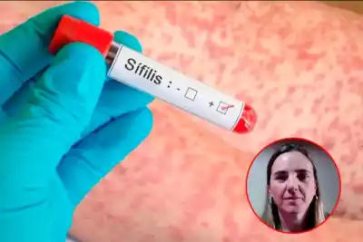 Alerta en Entre Ríos: los casos de sífilis crecieron un 47% y los médicos apuntan a un factor clave