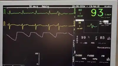 Un paciente con taquicardia ventricular fue estabilizado en Santa Ana gracias a la telemedicina