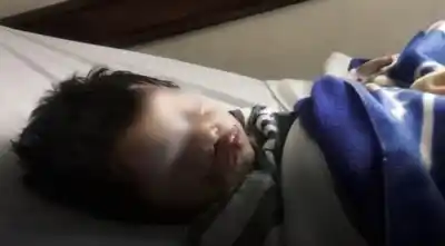 Un nene de 3 años fue atacado por un perro en Salta: la operación de urgencia y el pedido de ayuda