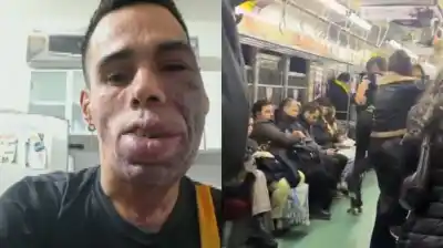 Un campeón de patín sufrió un ataque en el subte y ahora necesita $3.700.000 para volver a competir