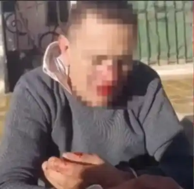 Un chofer de app fue acusado de acoso en plena calle y terminó golpeado por los vecinos