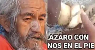 Su pierna se pudría en la calle y nadie lo asistía: la desesperación de un salteño que conmovió a Tartagal