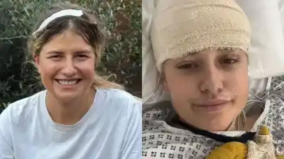 Una caída por las escaleras llevó a una joven a un hallazgo médico que la dejó sin palabras