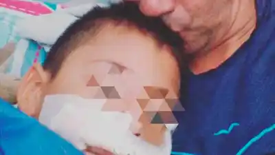Un nene de 7 años terminó con heridas en el rostro tras un ataque en la vía pública