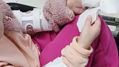 La férula que una nena de 12 años necesitaba: la crearon con una impresora 3D en Cutral Co