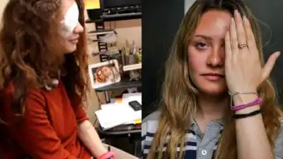 A los 13 años una compañera le lanzó un objeto a la cara y quedó ciega de un ojo: hoy lucha contra el bullying