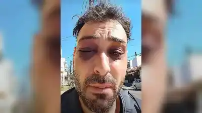 Un músico denunció una brutal golpiza policial en la Terminal de Santa Rosa