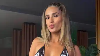 Julieta Poggio sorprendió con una imagen inesperada tras un accidente que dejó una dolorosa marca