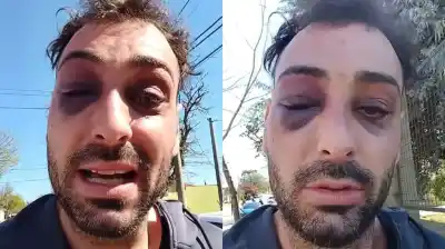 Un músico denunció que lo torturaron en una comisaría de Santa Rosa tras un reclamo por su guitarra