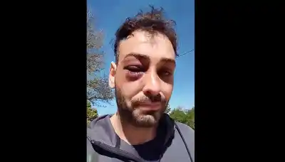 Denunció una brutal golpiza policial en Santa Rosa y el detalle que más indigna