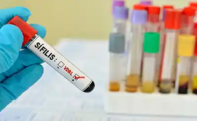 Salud detectó 434 casos de sífilis en Jujuy y lanza una advertencia sobre los testeos