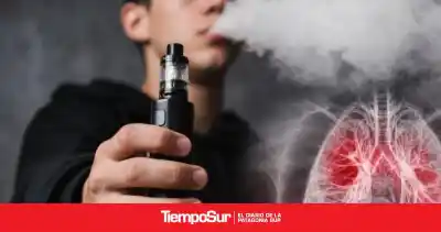 El proyecto que busca ponerle un freno a los vapeadores en Santa Cruz