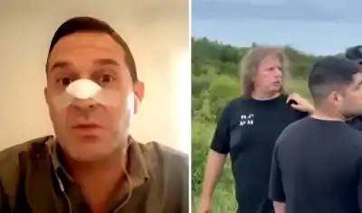 Diputado Pelli apunta contra la policía: pide investigar a los efectivos que estuvieron en el violento episodio de La Madrid