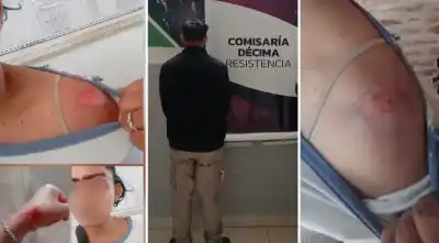 La persiguió, la atropelló y huyó: el detalle que lo hundió una semana después