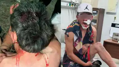 Una pelea por un pájaro en La Merced: uno terminó en el hospital y otro demorado