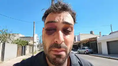 Un músico denunció una golpiza policial en Santa Rosa: siete efectivos van a juicio y hay fecha