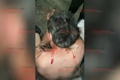 Fue a reclamar un pájaro con un cuchillo y terminó tendido en la calle: lo que dijo el vecino lo cambió todo