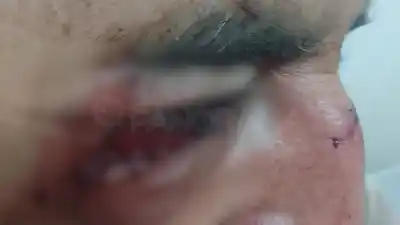 Salió al fondo de su casa a tapar el fuego y volvió con lesiones: "Me levantaba por el aire"