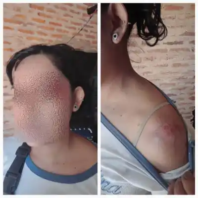 La atropelló con su camioneta y huyó: lo que pasó cuando ella fue a denunciarlo