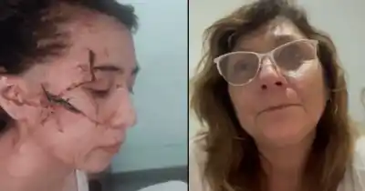 La escalada de violencia que nadie detuvo: una adolescente desfigurada y un tiroteo que conmocionó a una comunidad