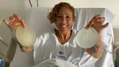 Se puso implantes tras tener tres hijos, empezó a sentirse mal y lo que halló adentro la dejó sin palabras