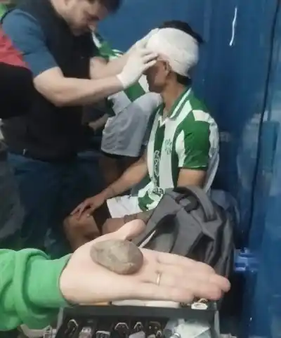 Villa Krause: el defensor que cayó por una piedra desde la tribuna y cómo sigue su recuperación