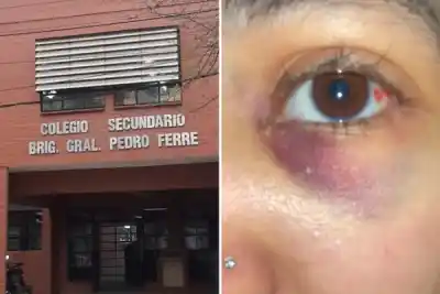 La golpearon en el patio de la escuela, la operación cuesta $6 millones y su agresora ya volvió a clases