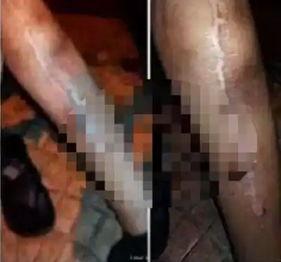 Una familia de Mosconi pide ayuda urgente: su hija está internada en Salta y el cuadro se complicó