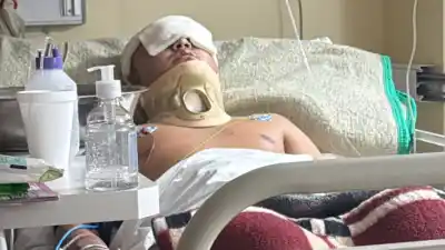 Le pegaron por la espalda, cayó desmayado y ya lleva dos cirugías: el calvario de Axel no termina