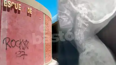 La pelea en el aula que dejó a una alumna de 14 internada y un dato que descolocó a la familia