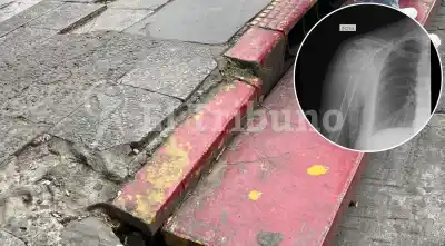 El cordón que la hizo caer en Mitre y Belgrano: 45 días postrada y un llamado que no llega