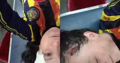 Volvía con su hijo tras festejar el título de Central y terminó con la cabeza rota: "La saqué barata"