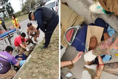 Iba a trabajar en moto, chocó contra un auto estacionado y los médicos hallaron algo raro en su muñeca