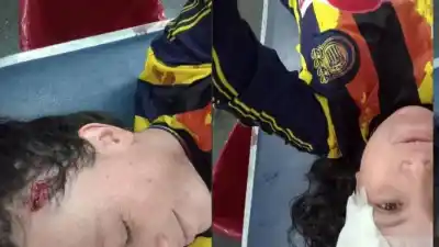 Festejaba el título de Central en moto con su hijo y terminó con puntos en la cabeza
