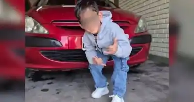 Se trepó al carro panchero de su familia y el agua hirviendo le cambió la vida: cómo sigue el nene de Pocito