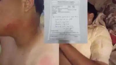 ¿Qué pasó en el aula que dejó a un estudiante con quemaduras graves?