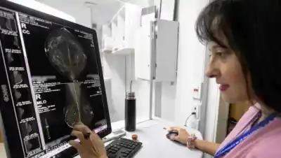 La mamografía que ahora se hace sin orden médica y en 12 hospitales: quiénes pueden acceder