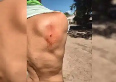 Le retuvieron la moto por no tener papeles y terminó apuñalando a un inspector en la espalda