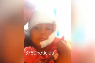 Añatuya: un pitbull entró al patio de noche y atacó a Aitana, de 3 años