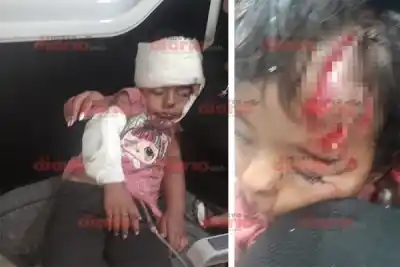 El perro que atacó a la nena de 3 años en Añatuya tendría dueño: quién sería el "Cabezón"