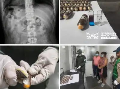 Cuatro pasajeros con dolores estomacales revelaron lo que llevaban dentro durante un control