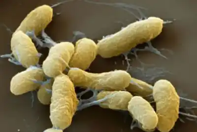 Aislaron a casi 200 personas en Siberia tras la muerte de una investigadora: la bacteria que puso en alerta al mundo