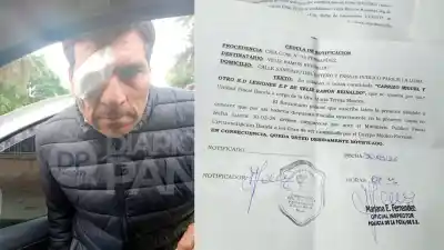 Un rulemán disparado con una gomera le arrebató la vista a un hombre mientras trabajaba
