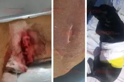 Sus pitbulls aparecieron con cuchillazos y ella apuntó directo al vecino: "Me cansaron estos perros"