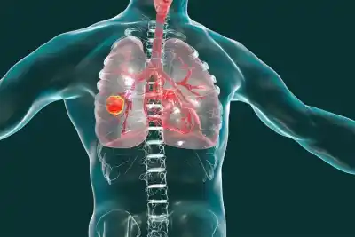 Le extirparon un tumor maligno al Papa: el dato clave que cambia su recuperación